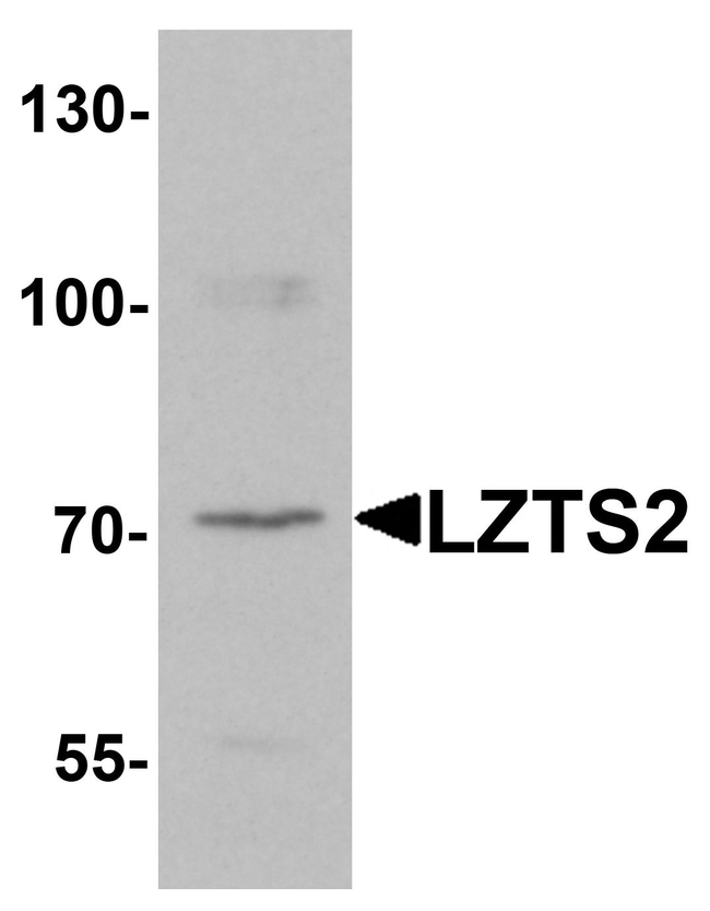 0.1MG LZTS2 0.1 MG