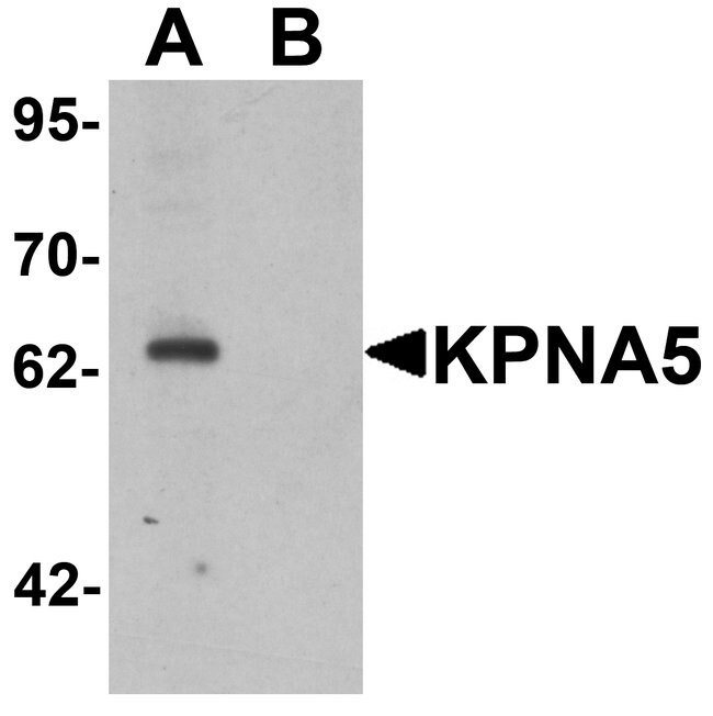 0.1MG KPNA5 0.1 MG