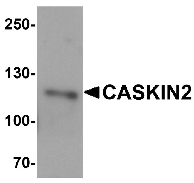 0.1MG CASKIN2 0.1 MG