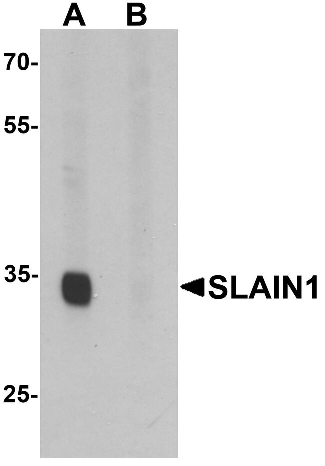 0.1MG SLAIN1 0.1 MG