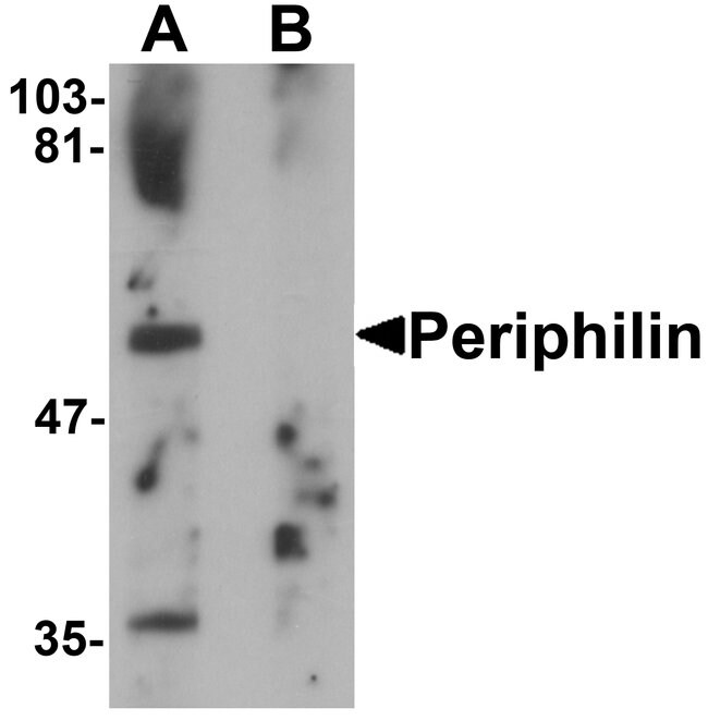 0.1MG PERILIPIN 1 0.1 MG