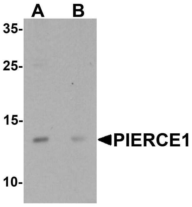 0.1MG C9ORF116 0.1 MG