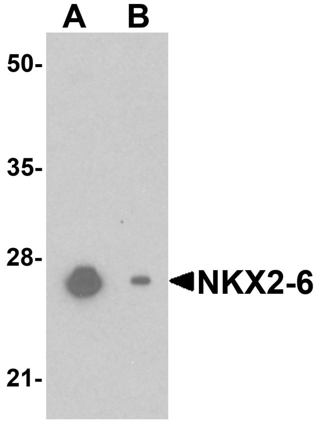 0.1MG NKX2.6 0.1 MG