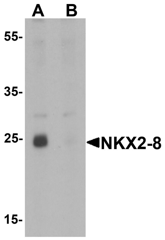 0.1MG NKX2.8 0.1 MG