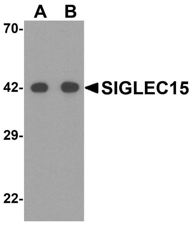 0.1MG SIGLEC15 0.1 MG