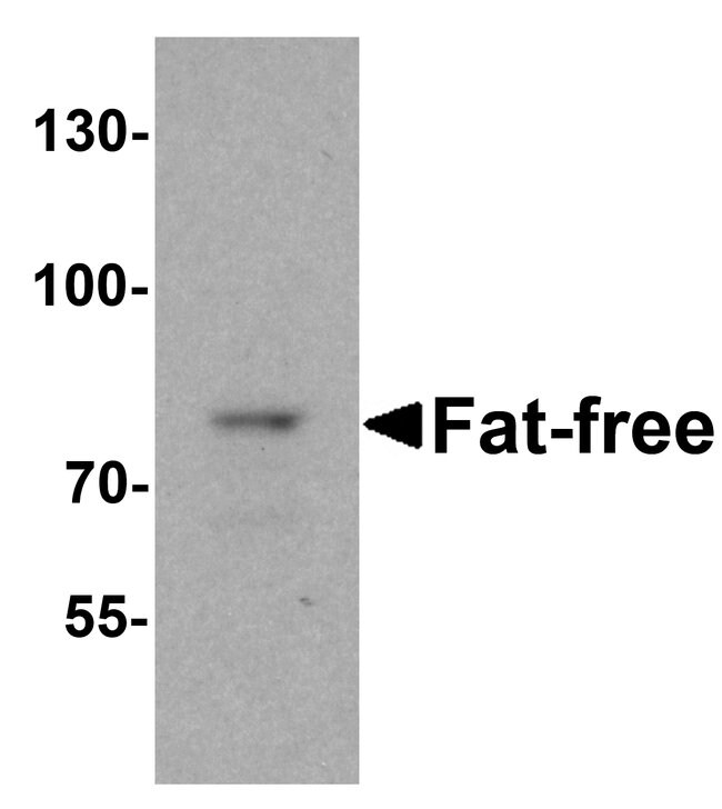 0.1MG VPS51 0.1 MG