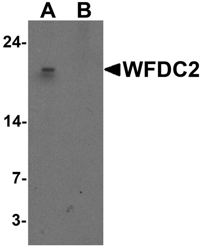 0.1MG WFDC2 0.1 MG