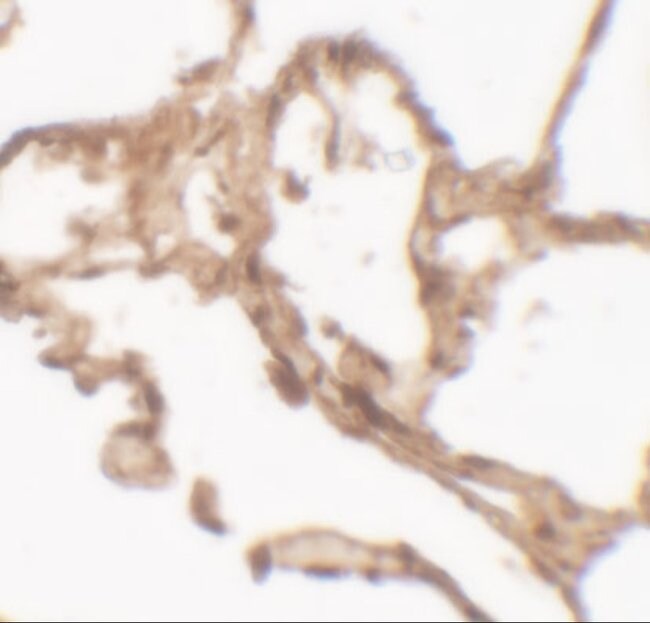 0.1MG ARYLSULFATASE B 0.1 MG