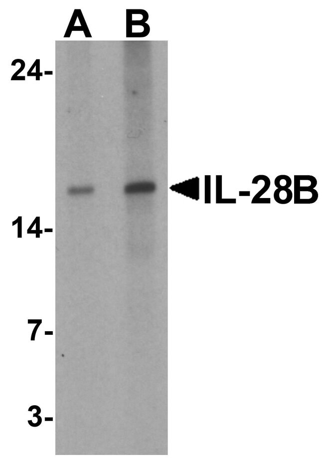 0.1MG IL-28B 0.1 MG