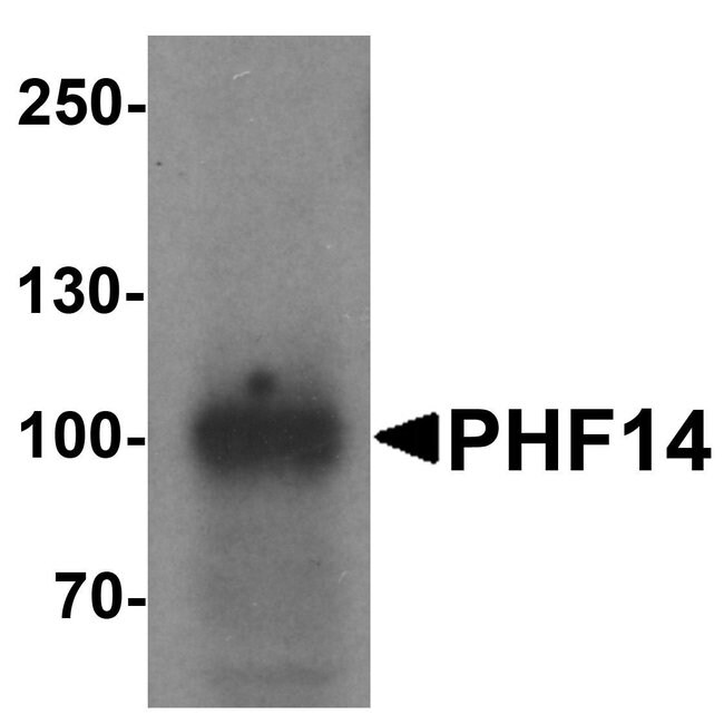 0.1MG PHF14 0.1 MG