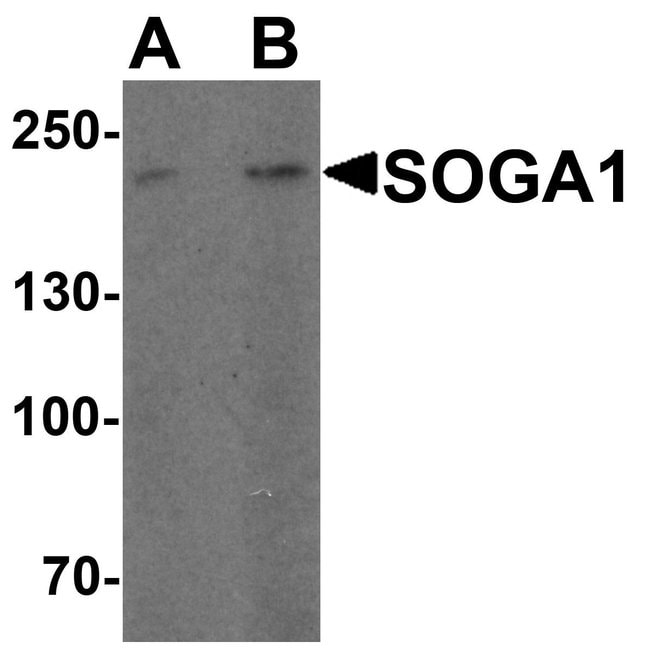 0.1MG SOGA1 0.1 MG