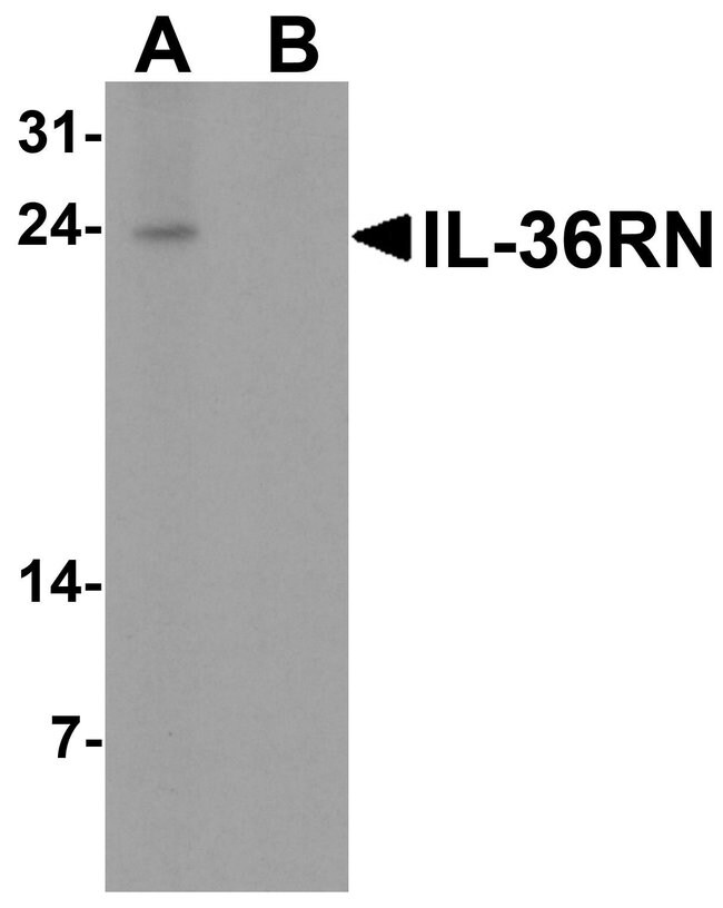 0.1MG IL1F5 0.1 MG