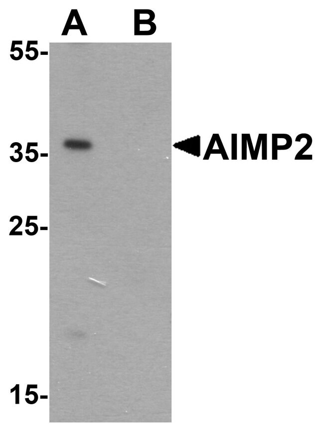 0.1MG JTV-1 0.1 MG