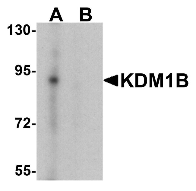 0.1MG KDM1B 0.1 MG