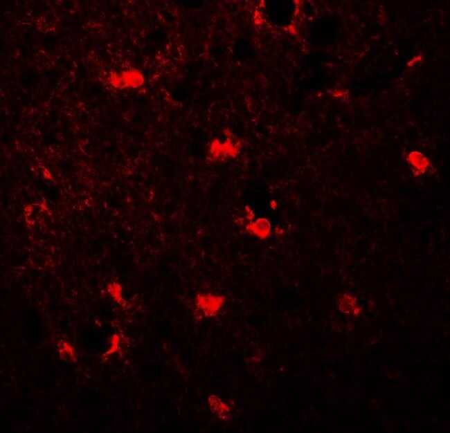 0.1MG MAP1LC3C 0.1 MG