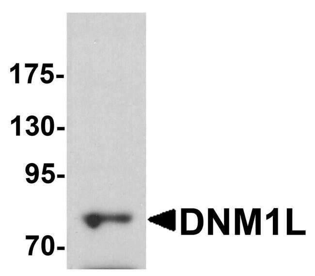 0.1MG DNM1L 0.1 MG