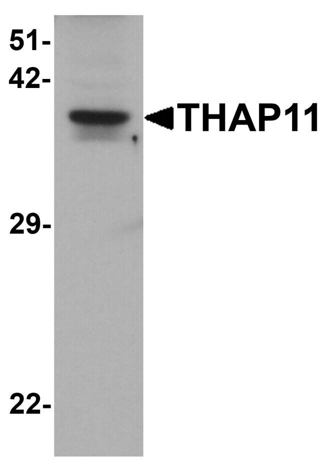 0.1MG THAP11 0.1 MG