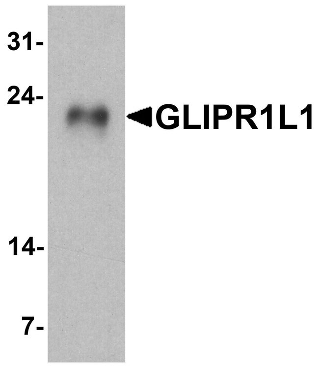 0.1MG GLIPR1L1 0.1 MG