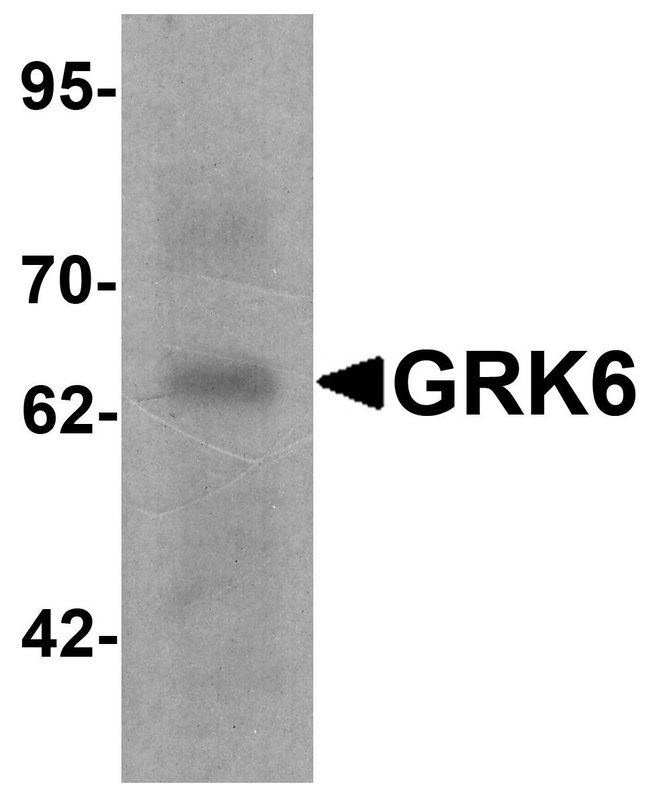 0.1MG GRK6 0.1 MG