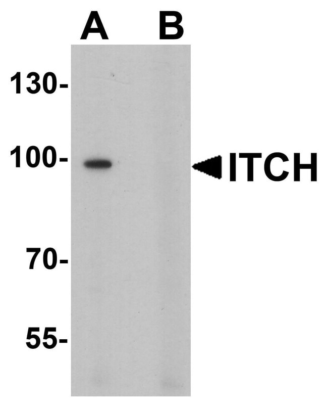 0.1MG ITCH 0.1 MG