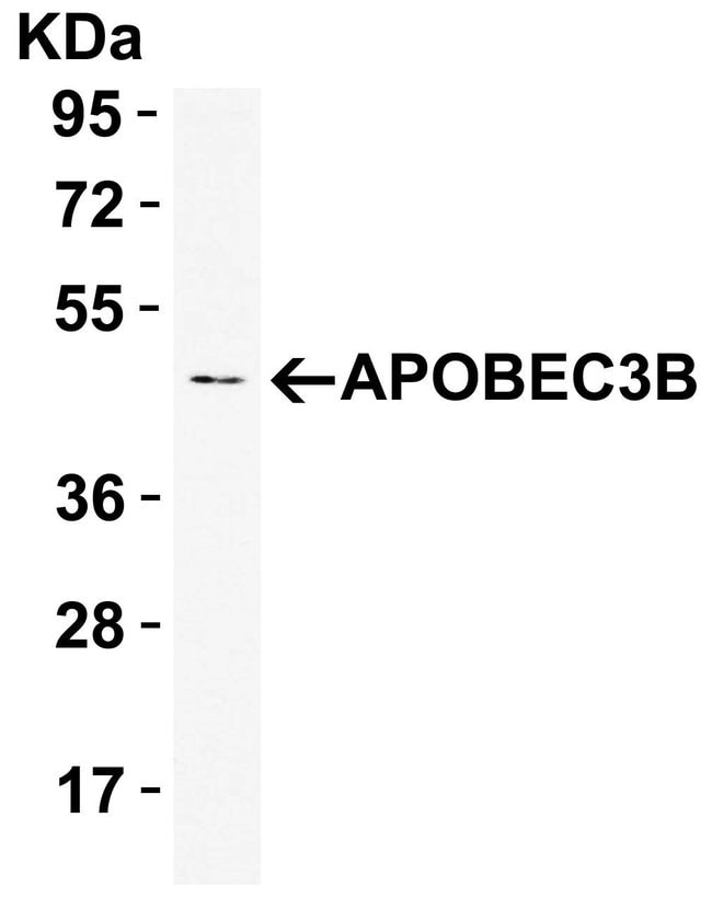 0.1MG APOBEC3B 0.1 MG