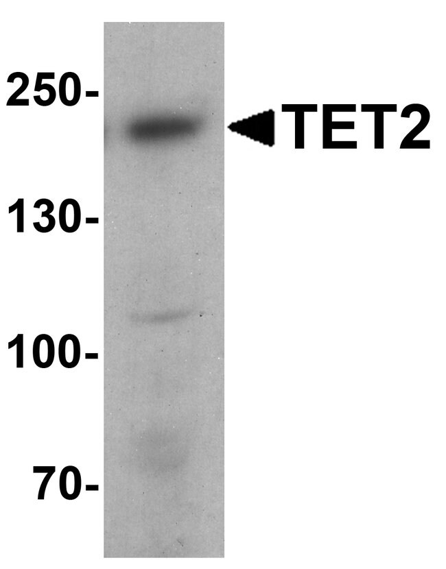 0.1MG TET2 0.1 MG