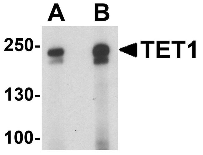 0.1MG TET1 0.1 MG