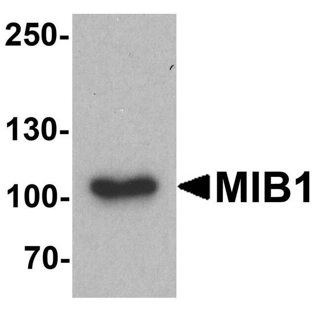 0.1MG MIB1 0.1 MG