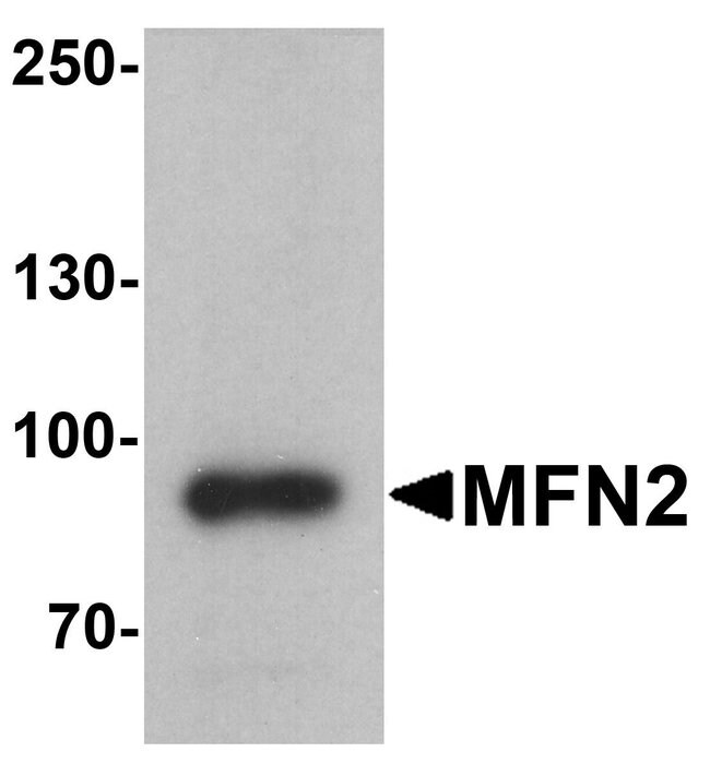 0.1MG MFN2 0.1 MG