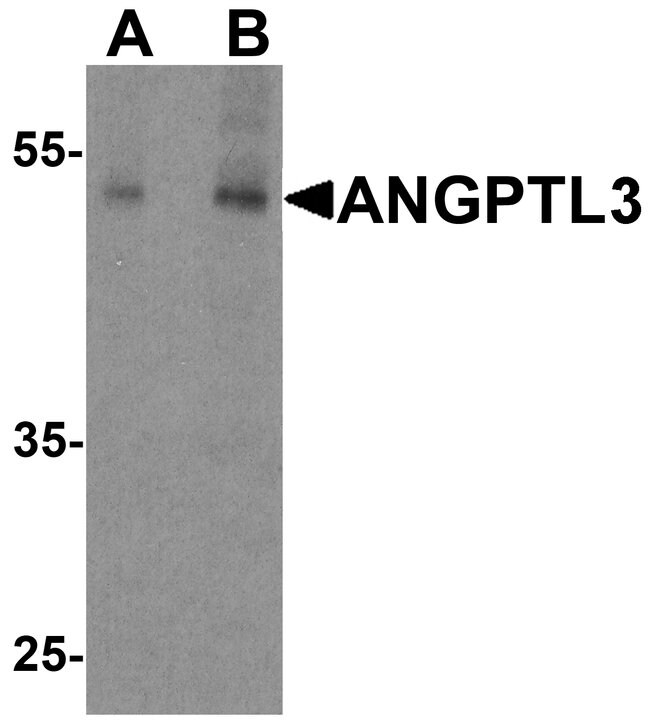 0.1MG ANGIOPOIETIN 3 0.1 MG