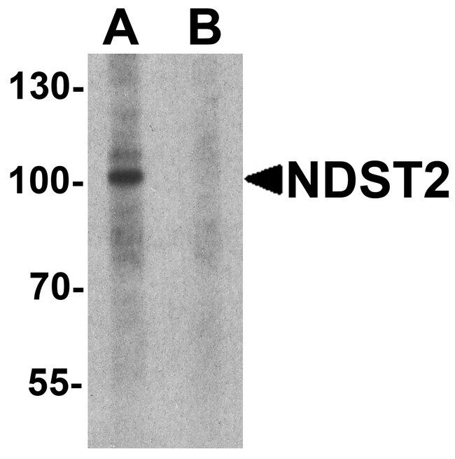 0.1MG NDST2 0.1 MG