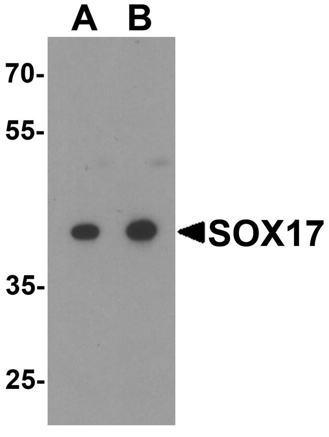 0.1MG SOX17 0.1 MG