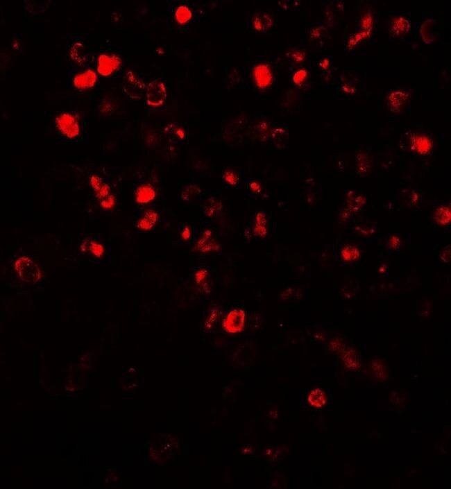 0.1MG NOX4 0.1 MG