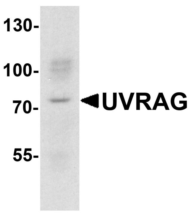 0.1MG UVRAG 0.1 MG