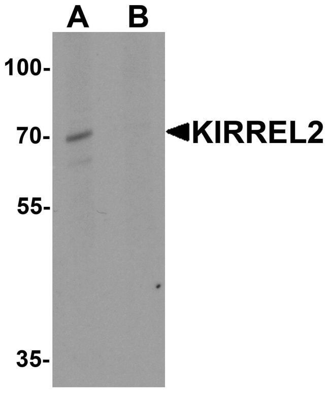 0.1MG KIRREL2 0.1 MG