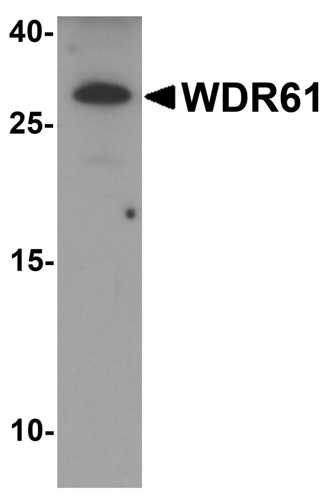 0.1MG WDR61 0.1 MG