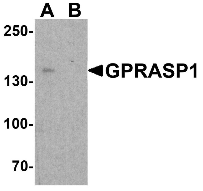 0.1MG GPRASP1 0.1 MG