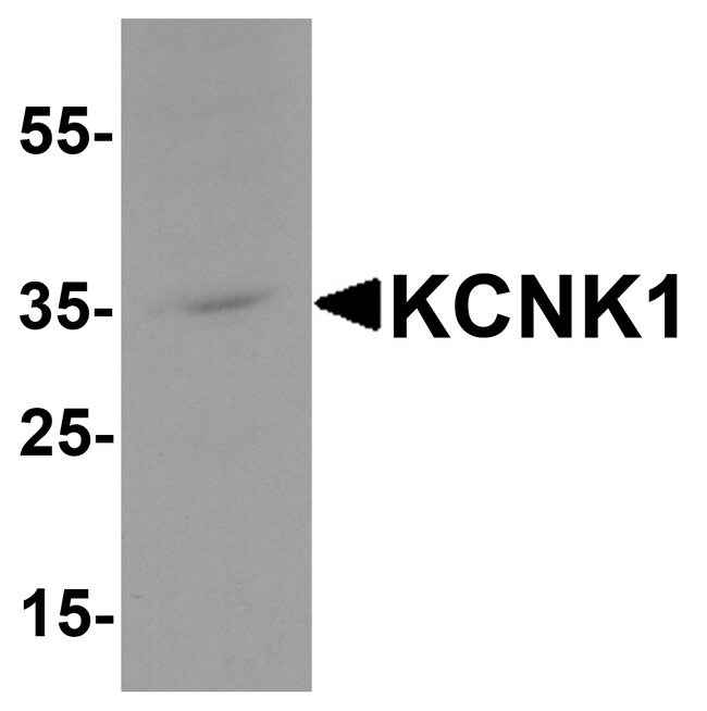 0.1MG KCNK1 0.1 MG