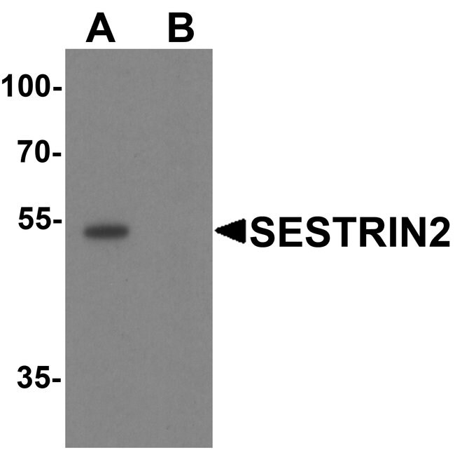 0.1MG SESN2 0.1 MG