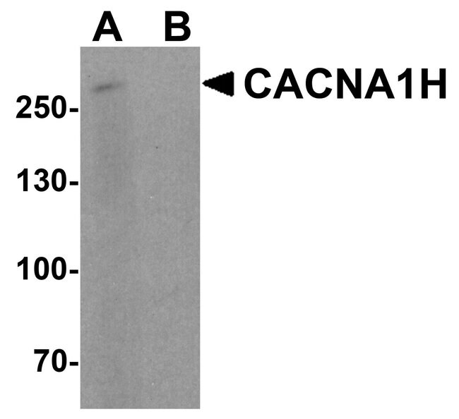 0.1MG CALCIUM CHANNEL 1H 0.1 MG