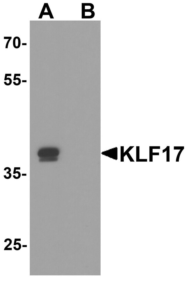 0.1MG KLF17 0.1 MG