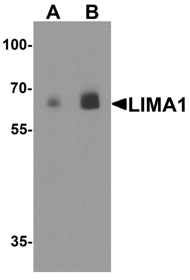 0.1MG EPLIN 0.1 MG