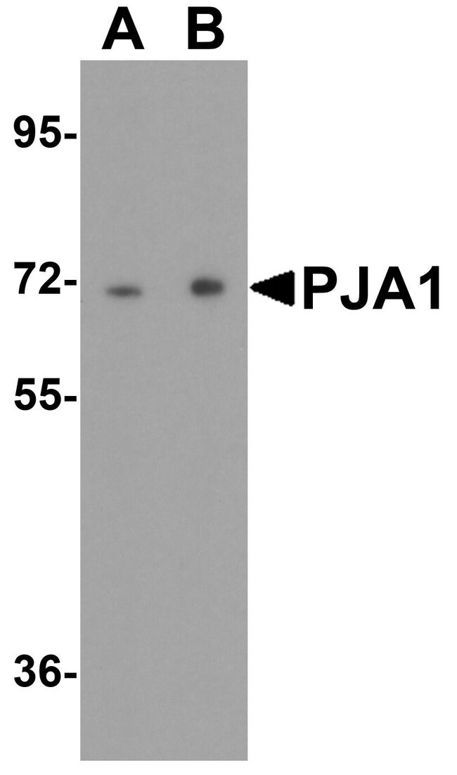 0.1MG PJA 0.1 MG