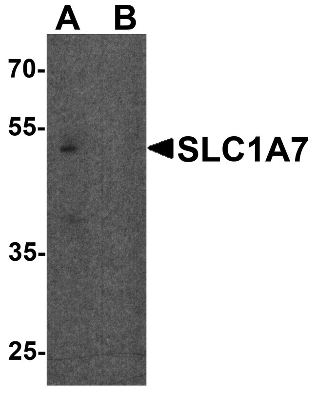 0.1MG SLC1A7 0.1 MG