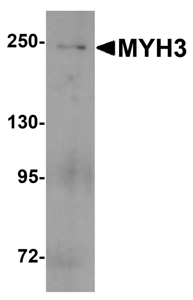 0.1MG MYH3 0.1 MG