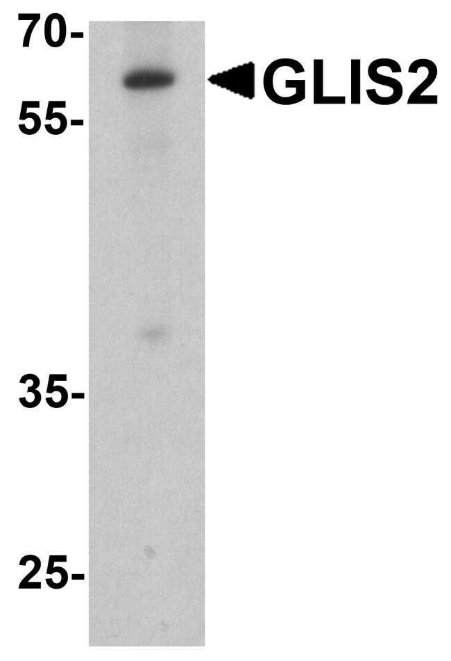 0.1MG GLIS2 0.1 MG