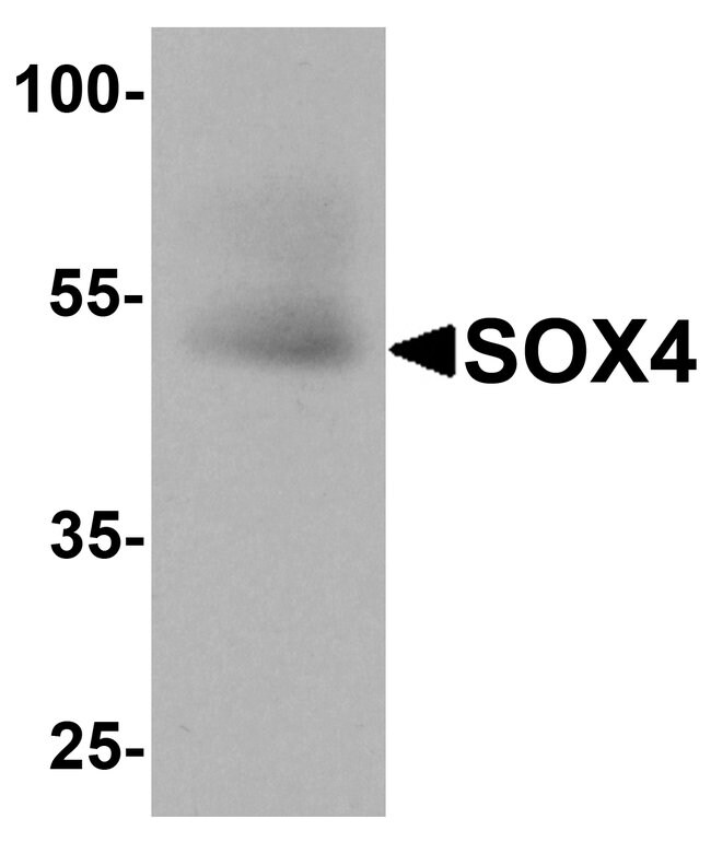 0.1MG SOX4 0.1 MG