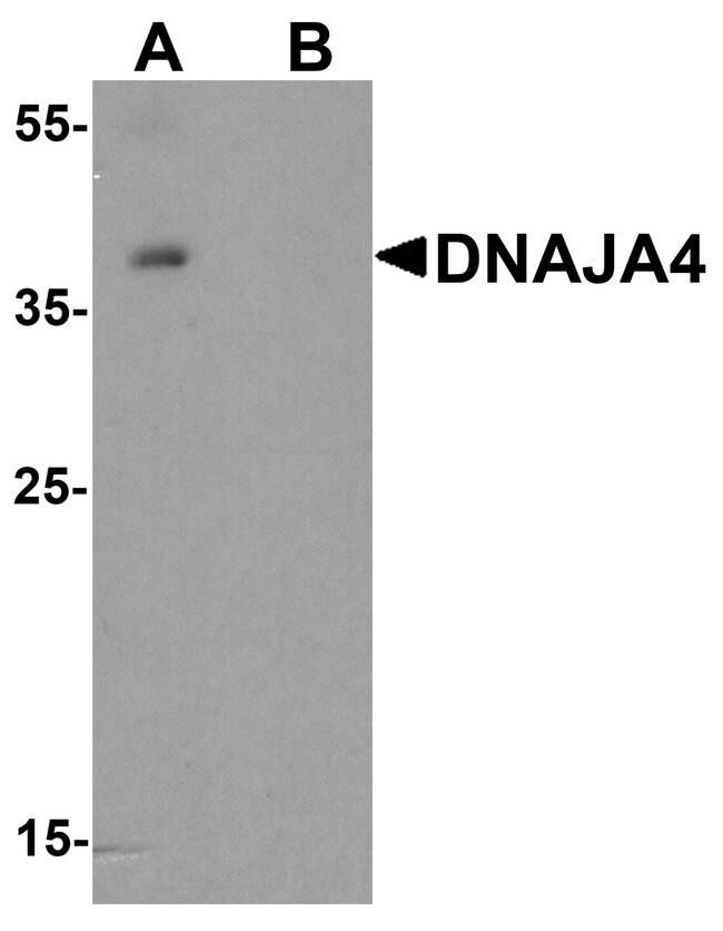 0.1MG DNAJA4 0.1 MG