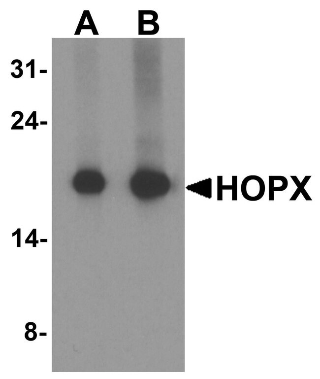 0.10MG HOPX