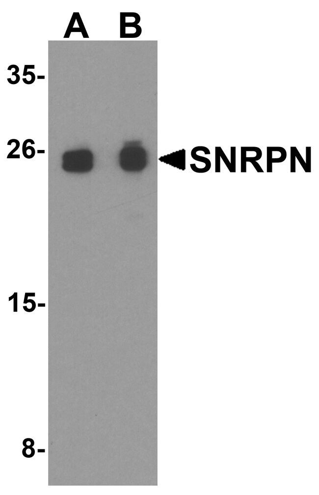 0.1MG SNRPN 0.1 MG